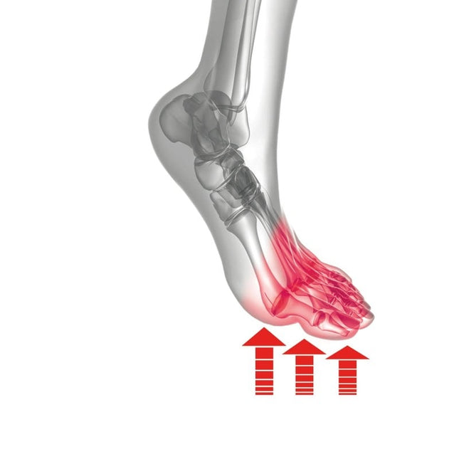 Medical insoles Forefoot complaints
